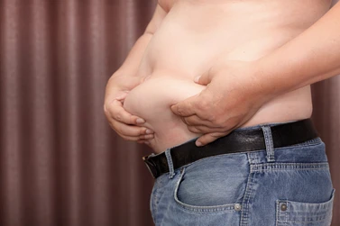 Magefett%20hos%20mann%20i%20bar%20overkropp